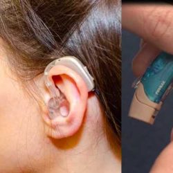 Hearing aid molds vs domes