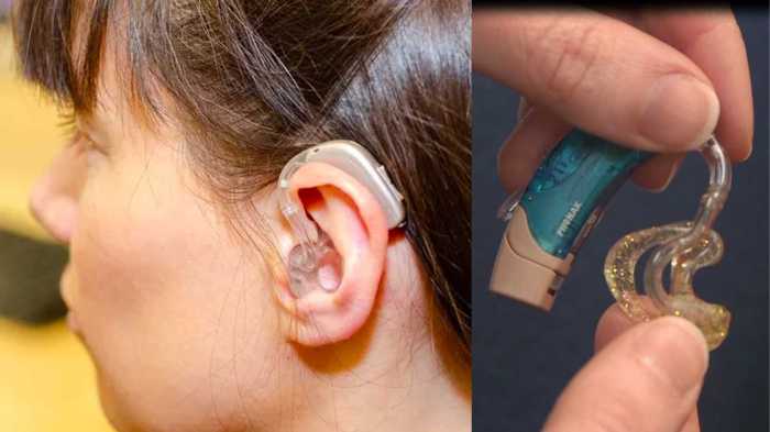 Hearing aid molds vs domes