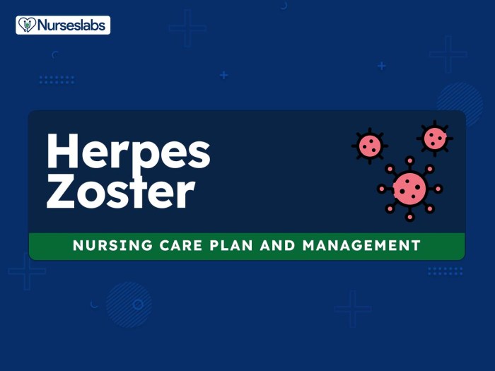 Herpes zoster shingles wikem