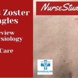 Nursing diagnosis for herpes zoster