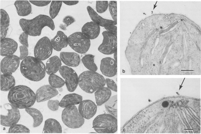 Electron cell micrograph animal transmission gopal murti dr nuclear photograph envelope science 2nd uploaded which may