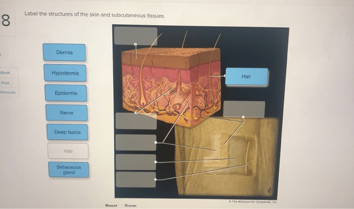 Label the structures of the skin and subcutaneous tissues